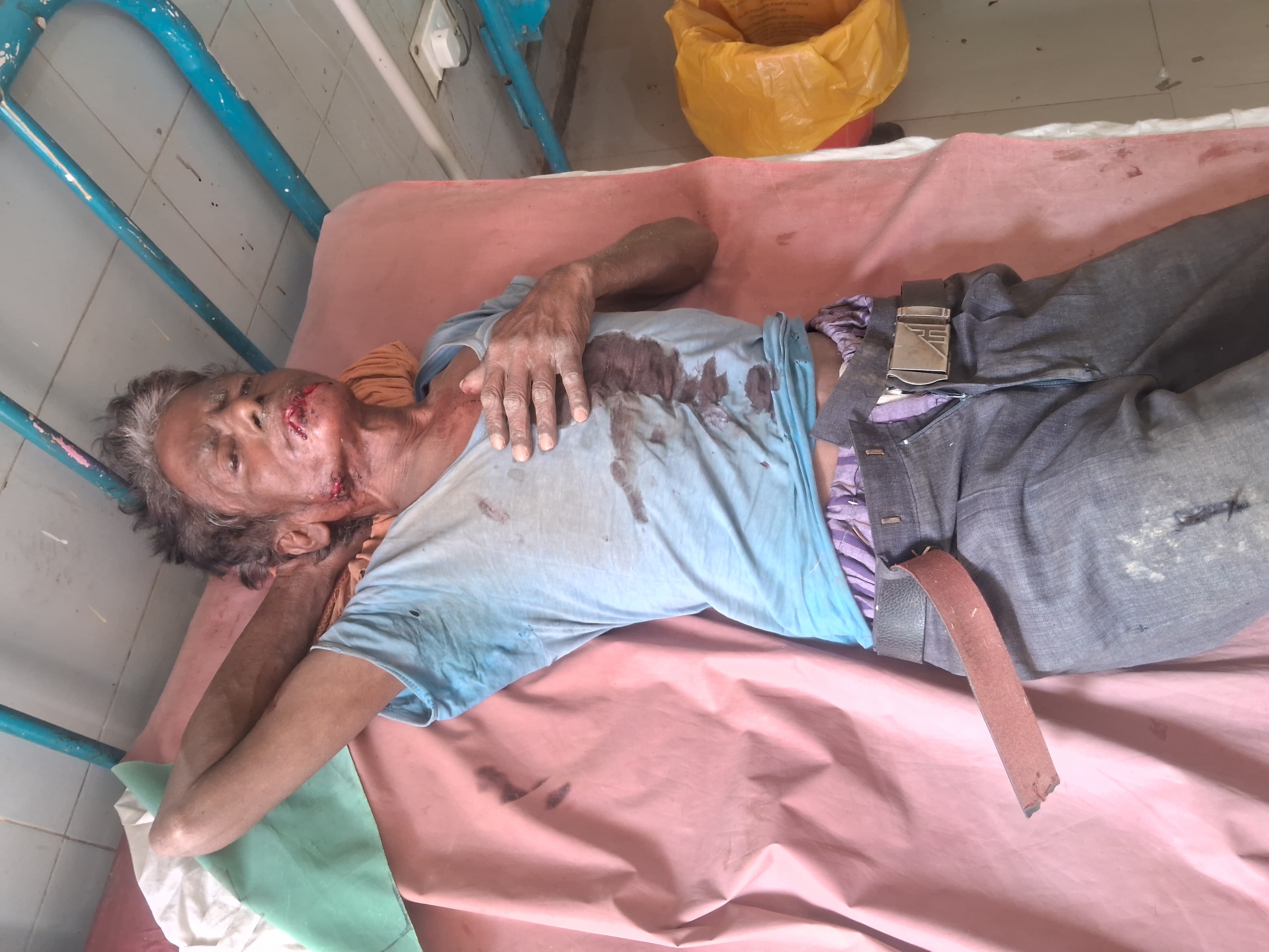 जंगली सियार के हमले से किसान घायल, गांव में दहशत