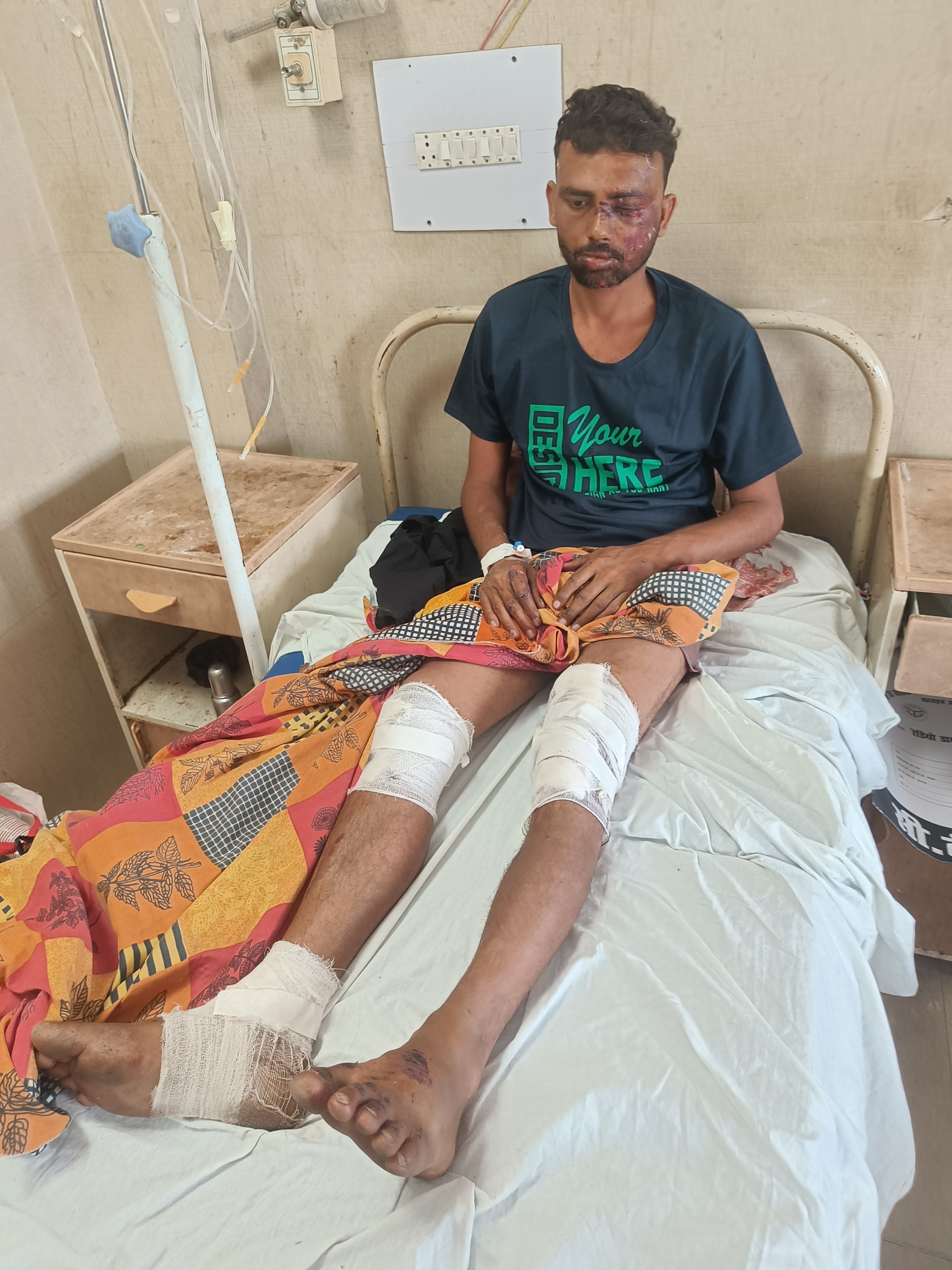 कल रात आठ बजे तेज़ रफ्तार कार की टक्कर से गंभीर रूप व्यक्ति घायल.......