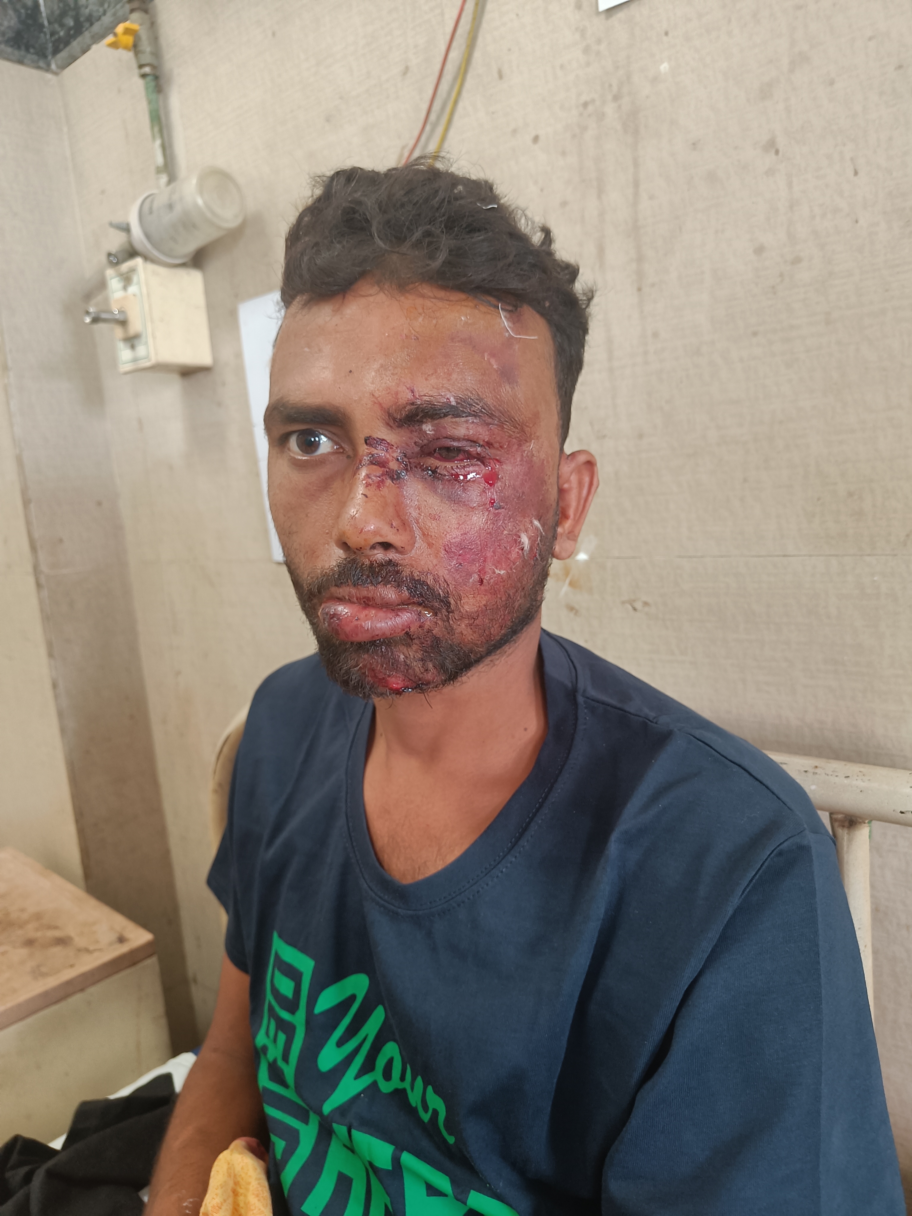 कल रात आठ बजे तेज़ रफ्तार कार की टक्कर से गंभीर रूप व्यक्ति घायल.......